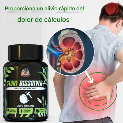 Stone Dissolver+™ – Eliminador Natural de Cálculos Renales