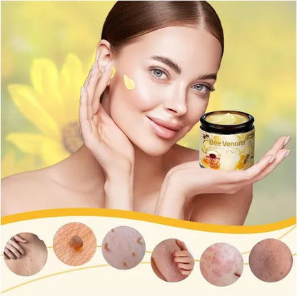 Bee Venom™ – Dile Adios a las Verrugas y Manchas