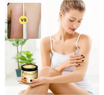 Bee Venom™ – Dile Adios a las Verrugas y Manchas